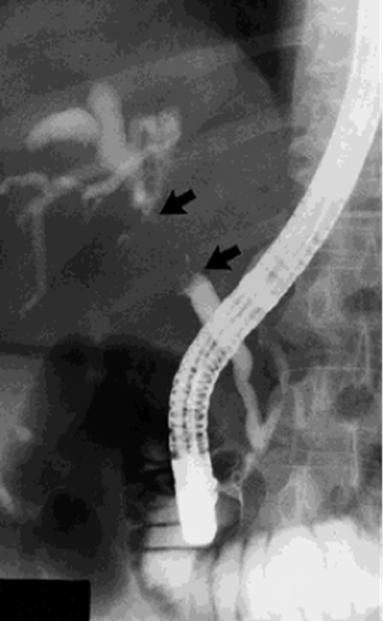 X-ray image