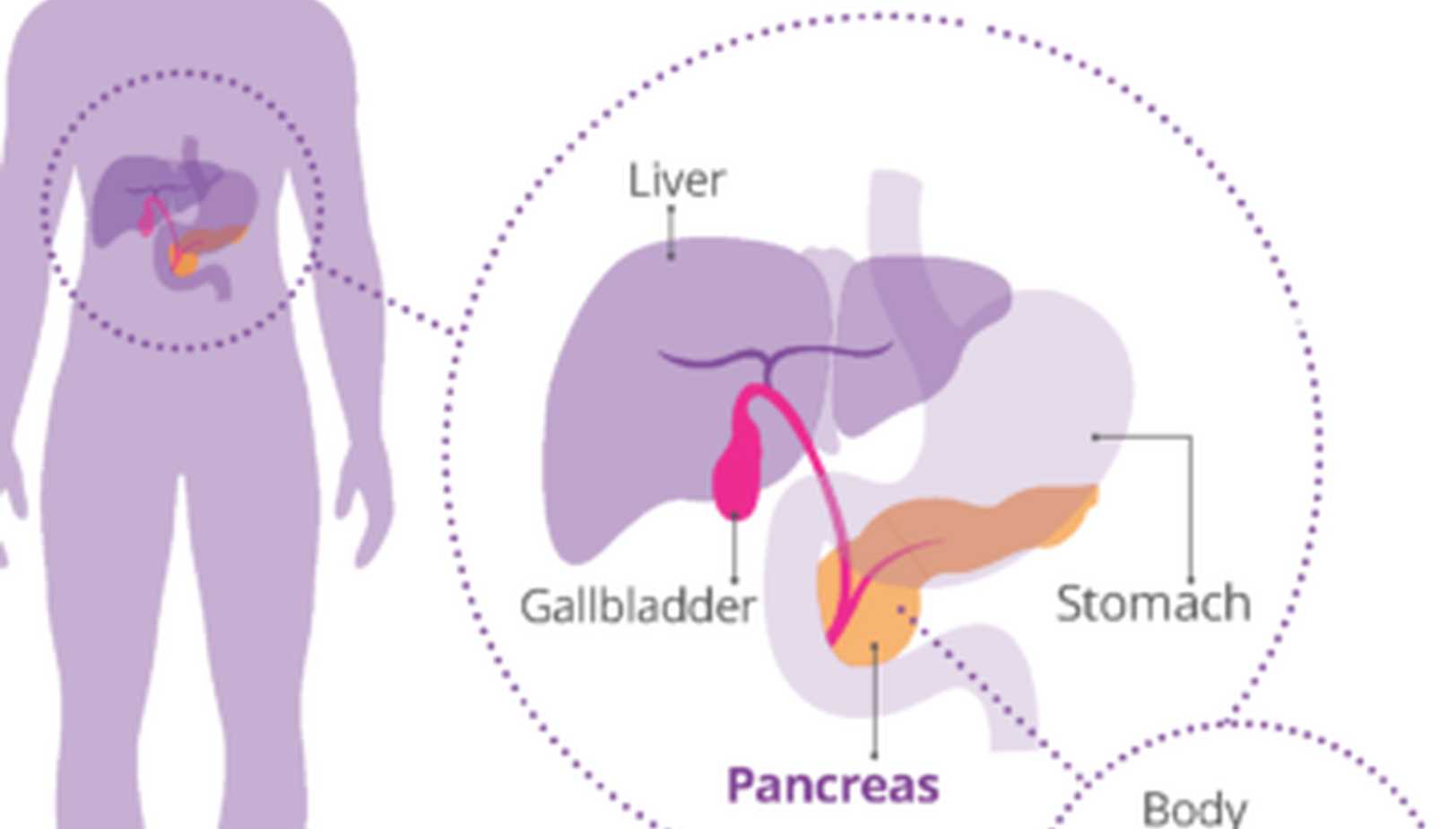 An image of the human body highlighting where the pancreas is located, with a close up image showing the pancreas and its neighbouring organs.